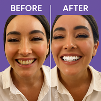 Dentifrice Blanchissant Avancé